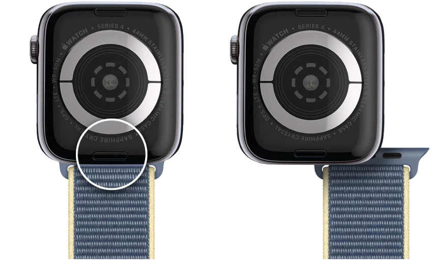 How to remove the straps from your Apple Watch
